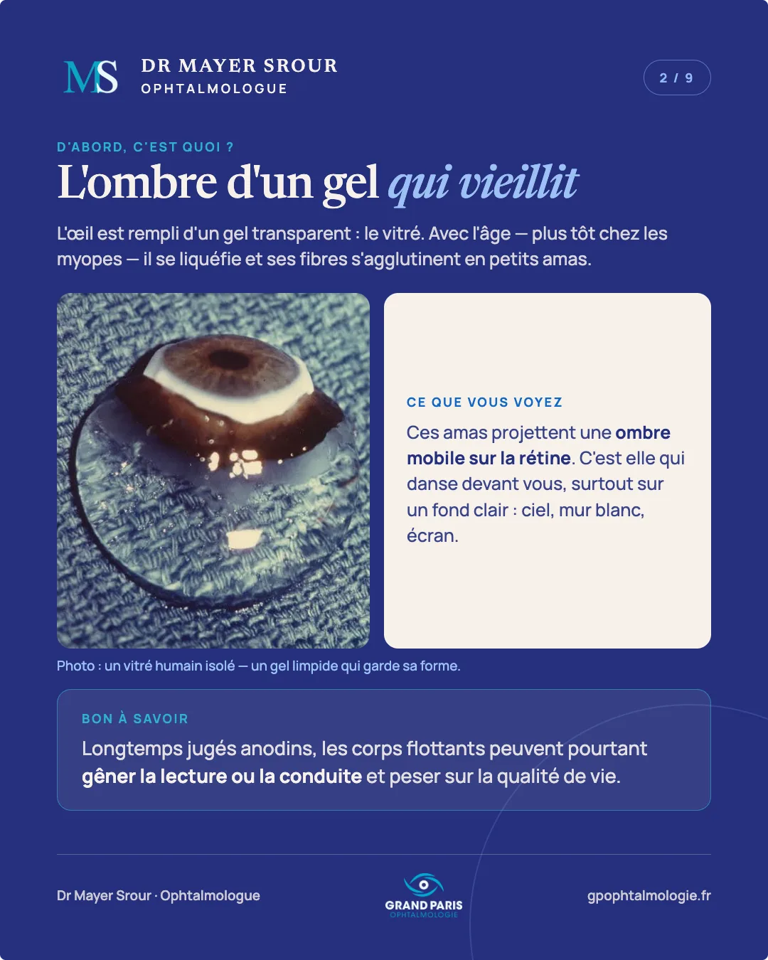 Visuel 2 sur 9 — L'ombre d'un gel qui vieillit