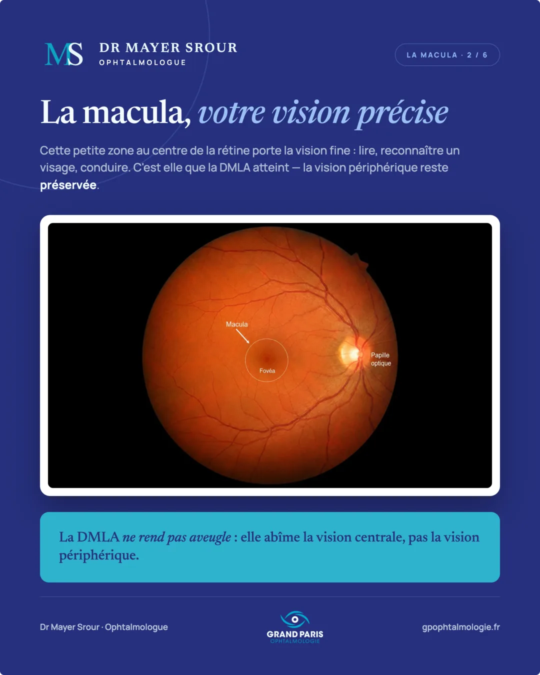 Visuel 2 sur 6 — La macula, votre vision précise