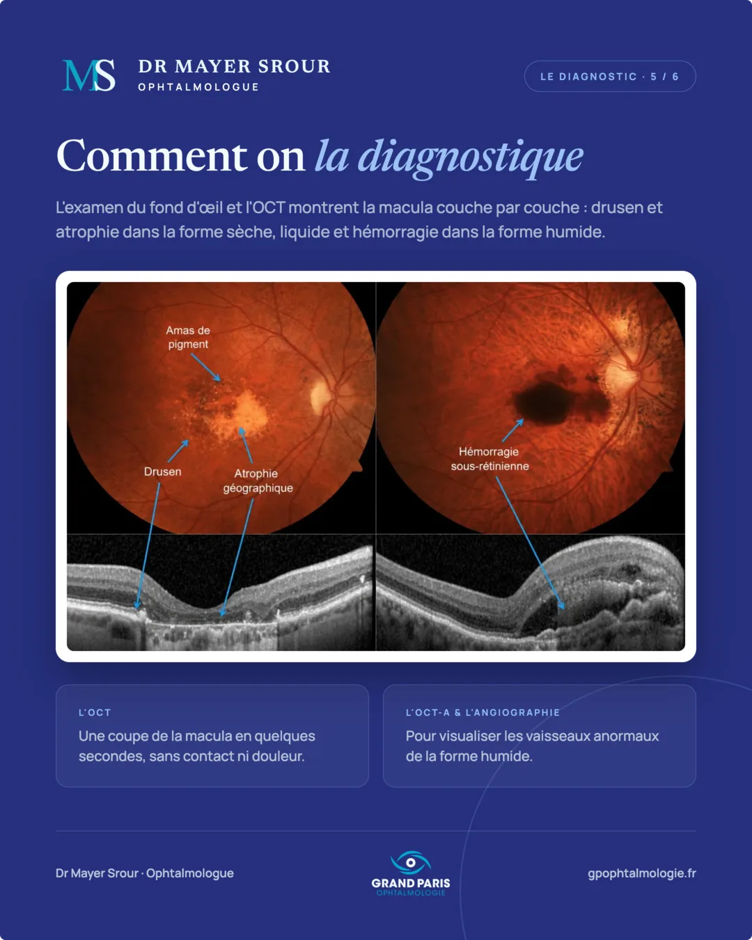 Visuel 5 sur 6 — Comment on la diagnostique