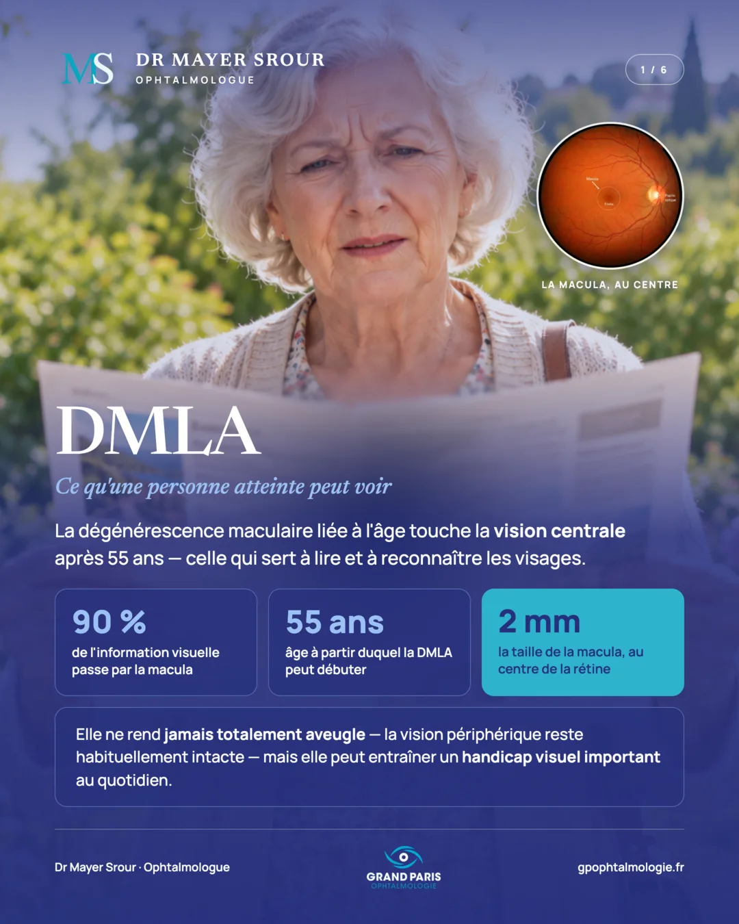Visuel 1 sur 6 — DMLA : ce qu'une personne atteinte peut voir