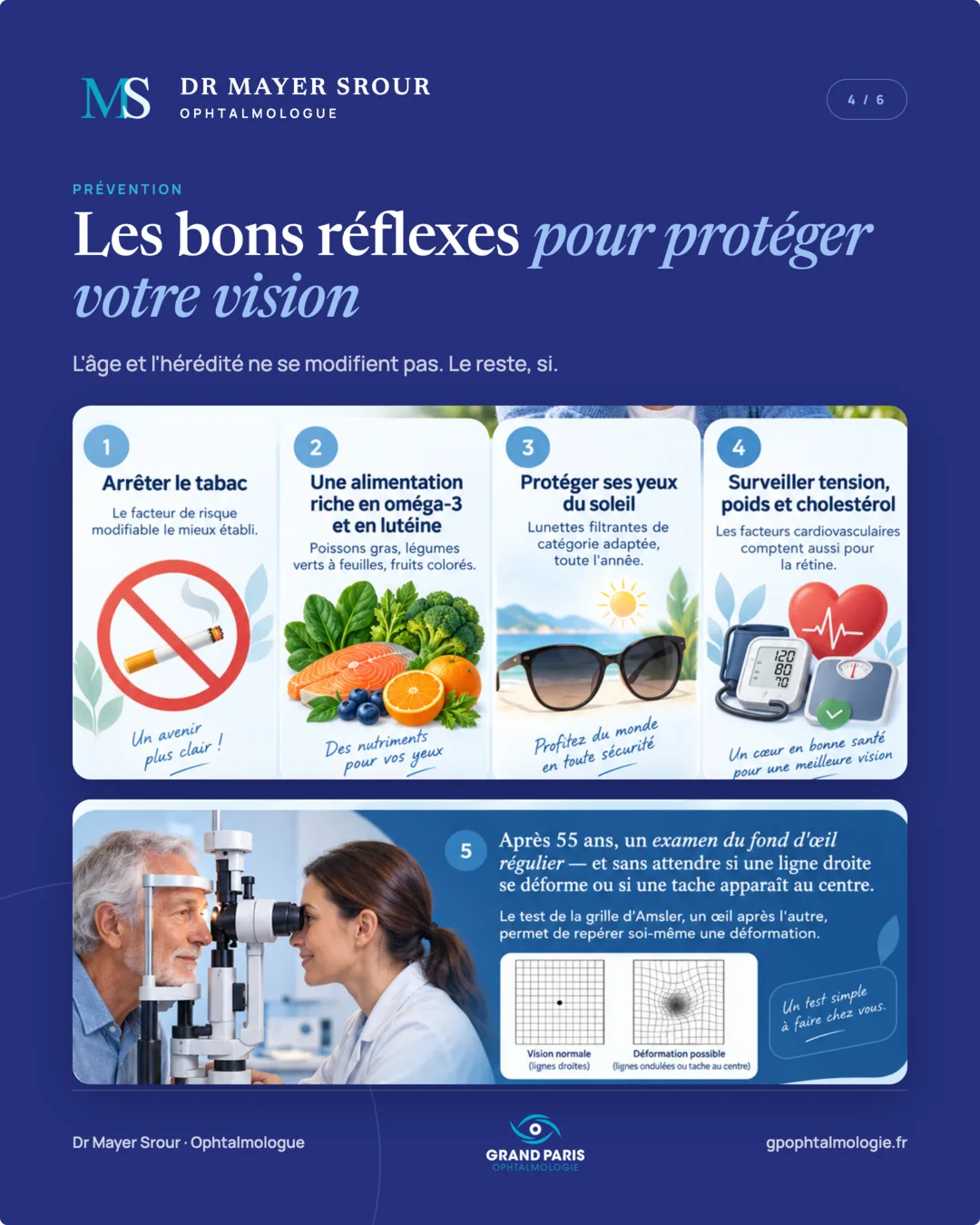 Visuel 4 sur 6 — Prévention : les bons réflexes pour protéger votre vision