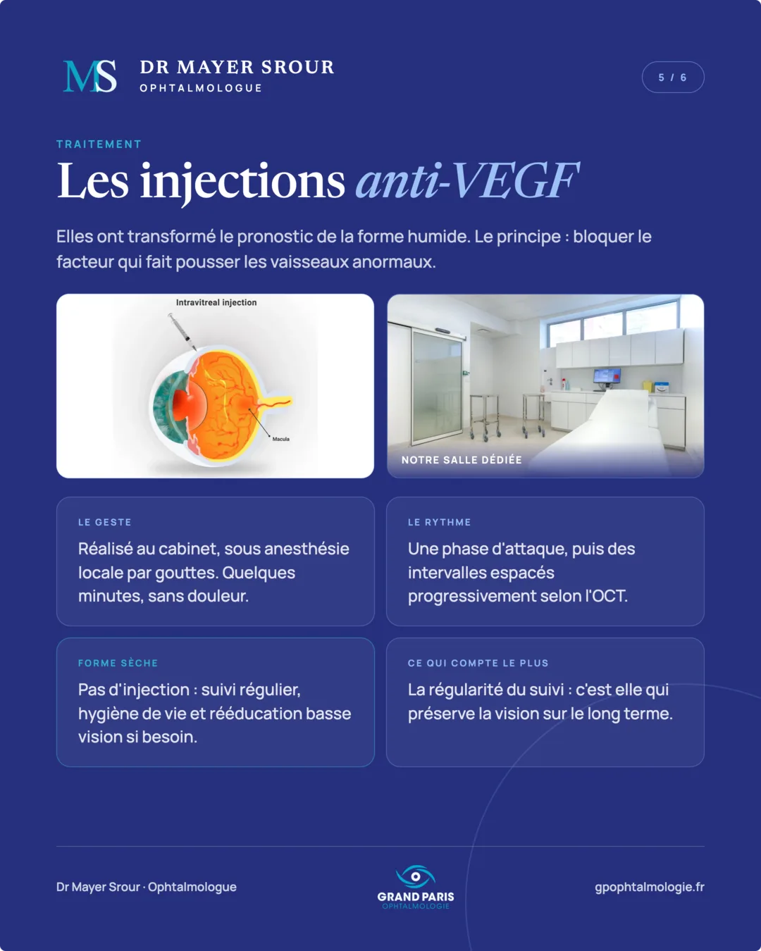 Visuel 5 sur 6 — Traitement : les injections anti-VEGF