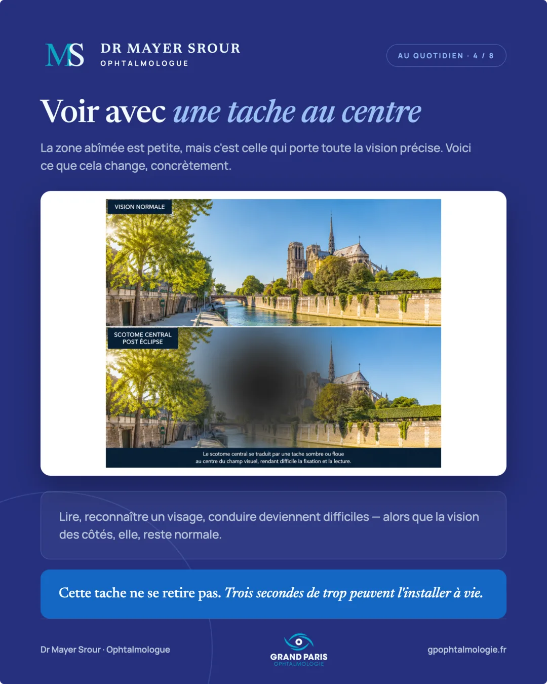 Visuel 4 sur 8 — Voir avec une tache au centre