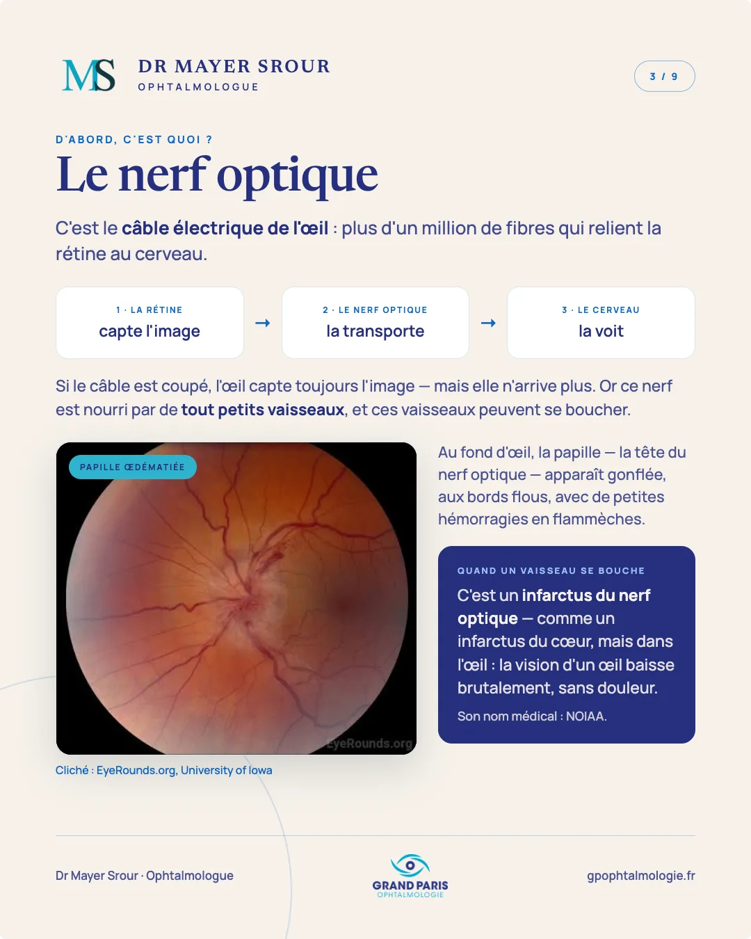 Visuel 3 sur 9 — D'abord, c'est quoi ? Le nerf optique