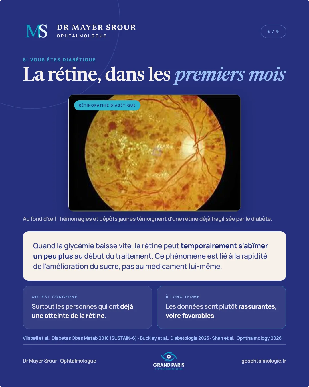 Visuel 6 sur 9 — Si vous êtes diabétique : la rétine, dans les premiers mois