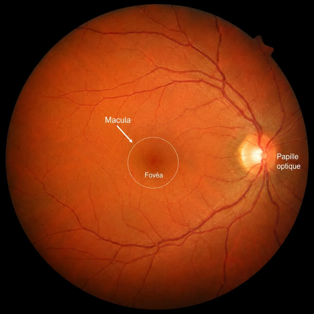 Rétinophotographie annotée : la macula et sa fovéa au centre de la rétine, la papille optique sur le côté