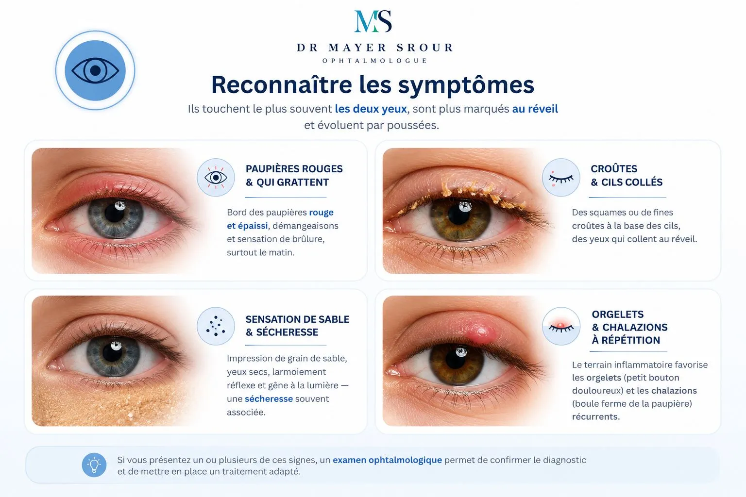 Infographie Dr Mayer Srour : reconnaître les symptômes de la blépharite — paupières rouges qui grattent, croûtes et cils collés, sensation de sable et sécheresse, orgelets et chalazions à répétition