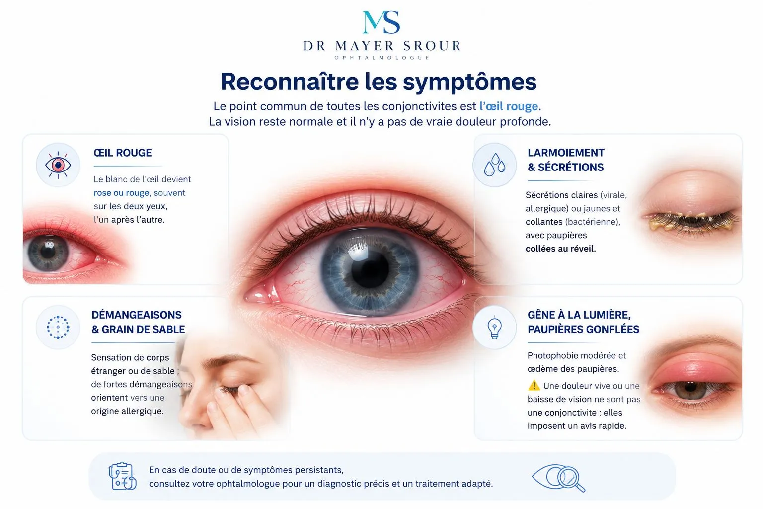 Infographie Dr Mayer Srour : reconnaître les symptômes d'une conjonctivite — œil rouge, larmoiement et sécrétions, démangeaisons et grain de sable, gêne à la lumière et paupières gonflées