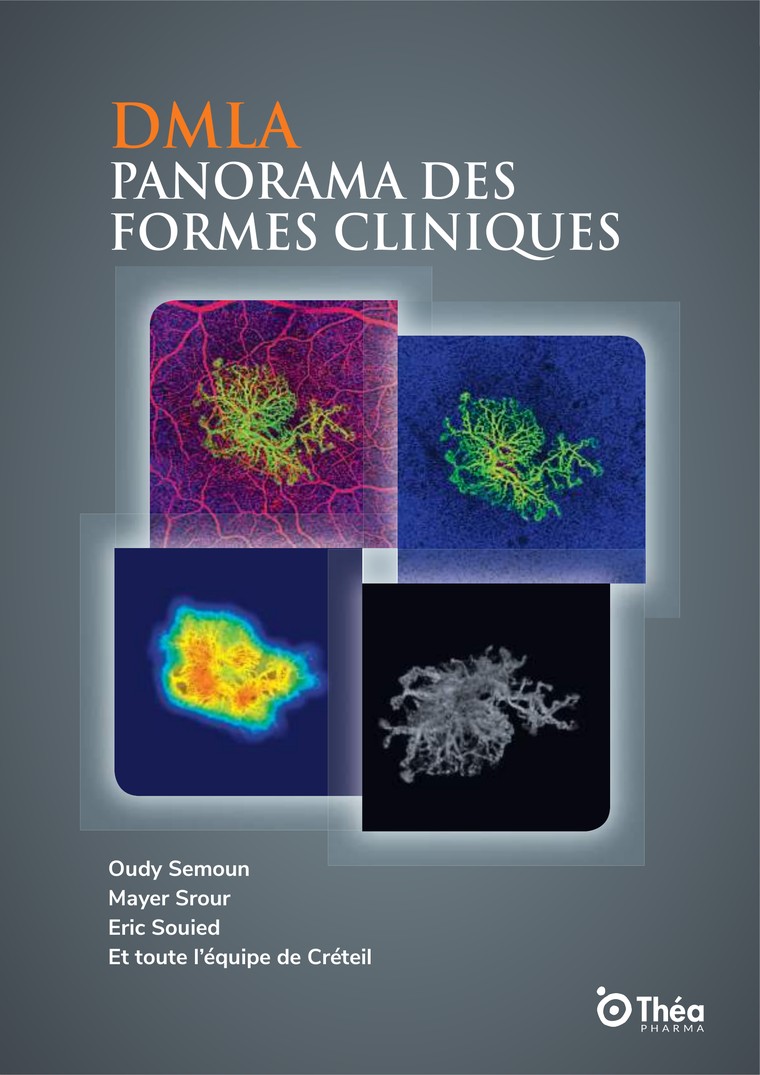 Couverture de l’ouvrage DMLA : panorama des formes cliniques, Théa Pharma 2019