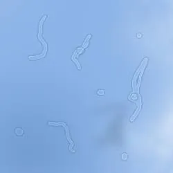 Mouches volantes : filaments et points translucides se détachant sur un ciel clair, tels que perçus par le patient