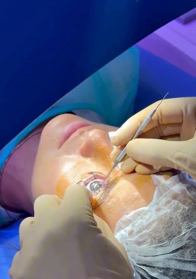 Chirurgie réfractive LASIK filmée au bloc opératoire par le Dr Mayer Srour